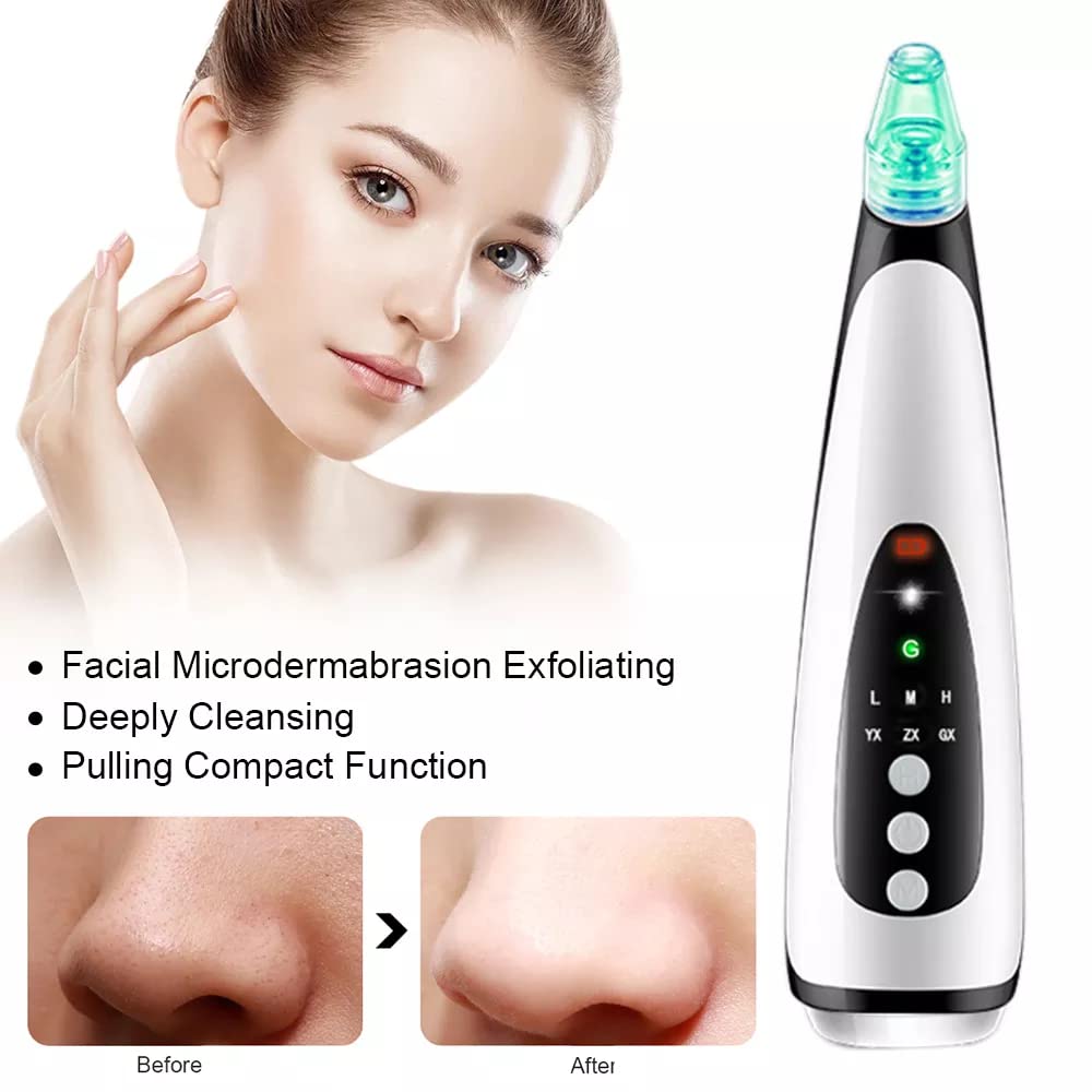6-in-1 Multifunction Blackhead Remover