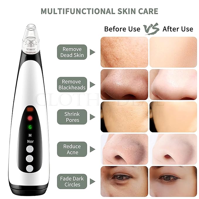 6-in-1 Multifunction Blackhead Remover