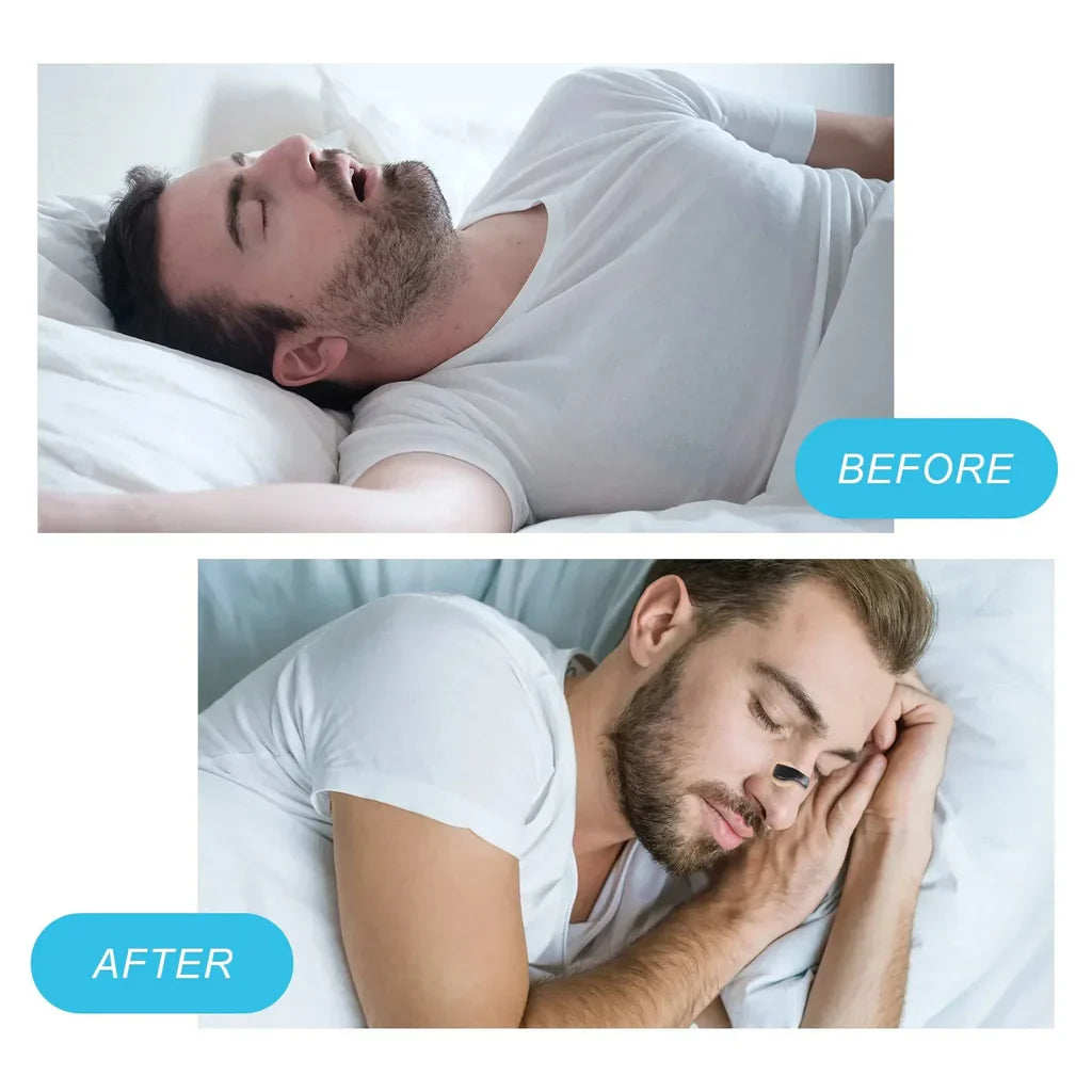 Plastic Nasal Strips for Breathing
